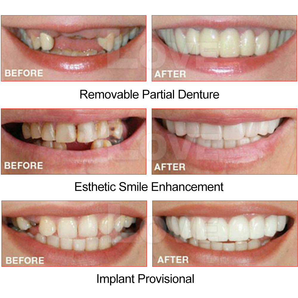 False Teeth