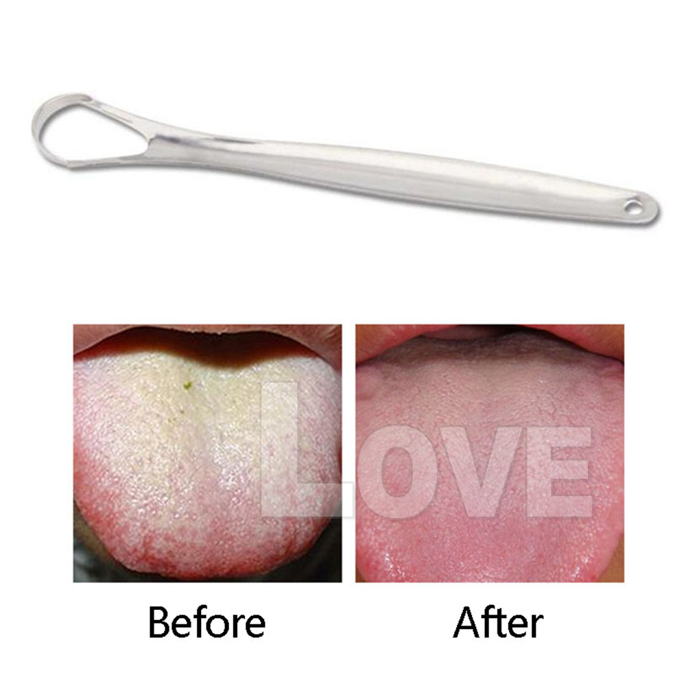 2PCS Tounge Cleaner Scraper Dental Care Oral Hygiene Tool Kit stainless